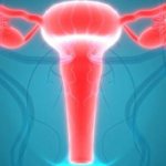 Хрупкая шейка матки: Симптомы, причины и методы лечения