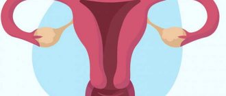 Uterus anteflexio: description, causes, symptoms, possible consequences - tips and recommendations about health on AllMedNews.ru