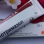 Clotrimazole ointment in packaging