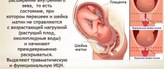 structural features of the uterus
