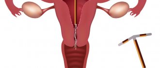 insert a uterine device