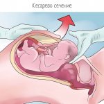 Cause of non-dilation of the cervix 6