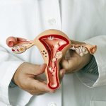 uterine cancer life expectancy