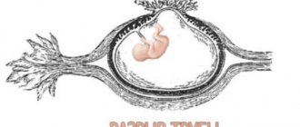 Разрыв трубы при внематочной беременности