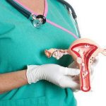 sanitation in gynecology