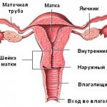 Схема матки: ИЦН при беременности
