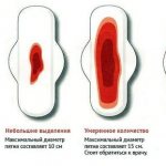 Types of discharge during menstruation